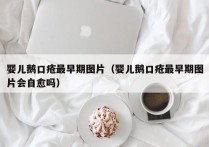 婴儿鹅口疮最早期图片（婴儿鹅口疮最早期图片会自愈吗）